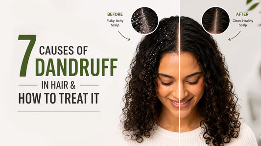 7 Causes of Dandruff in Hair and How to Treat It