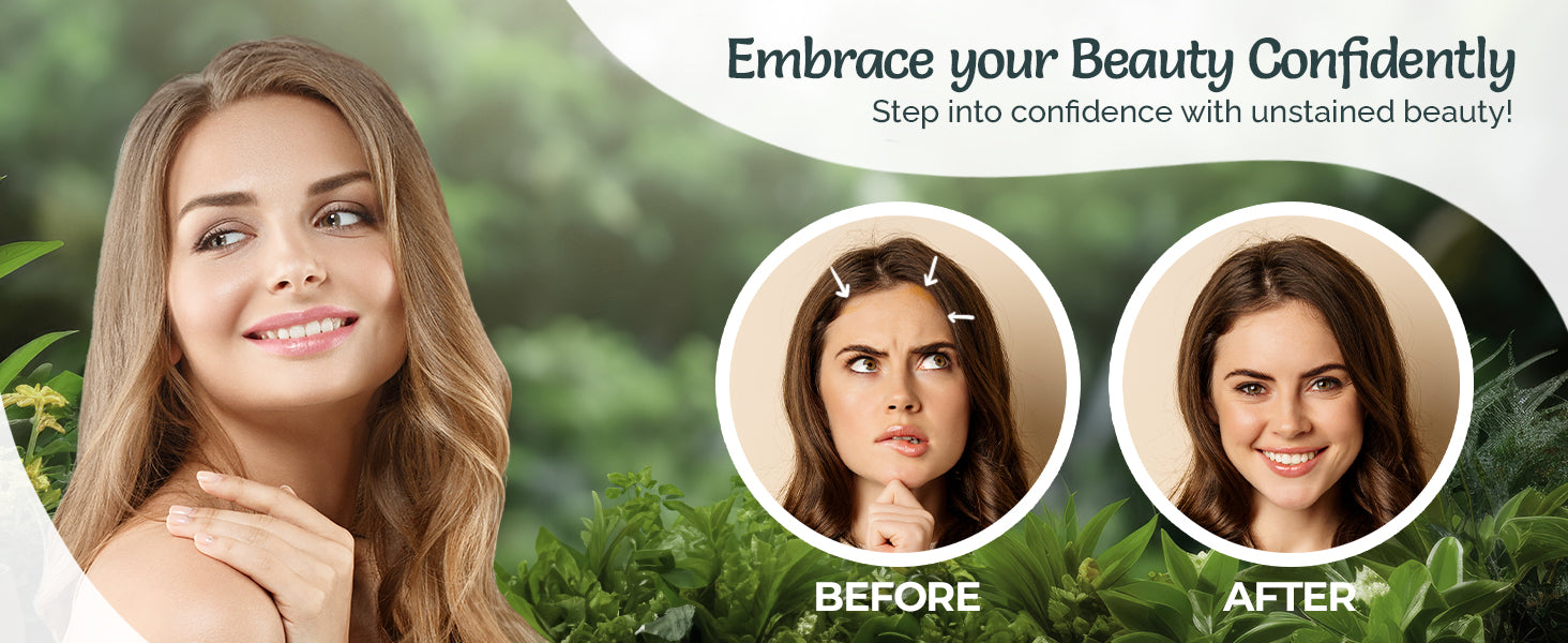 Hair Color Stain Remover Wipes- 5 pcs