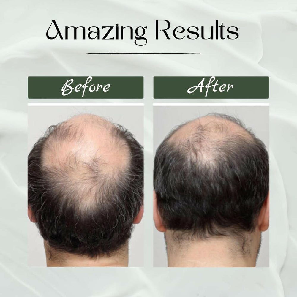 Ginger Hair Revitalizing Shampoo Jar with Deep Sea Salt - Herbishh Hair Dye.